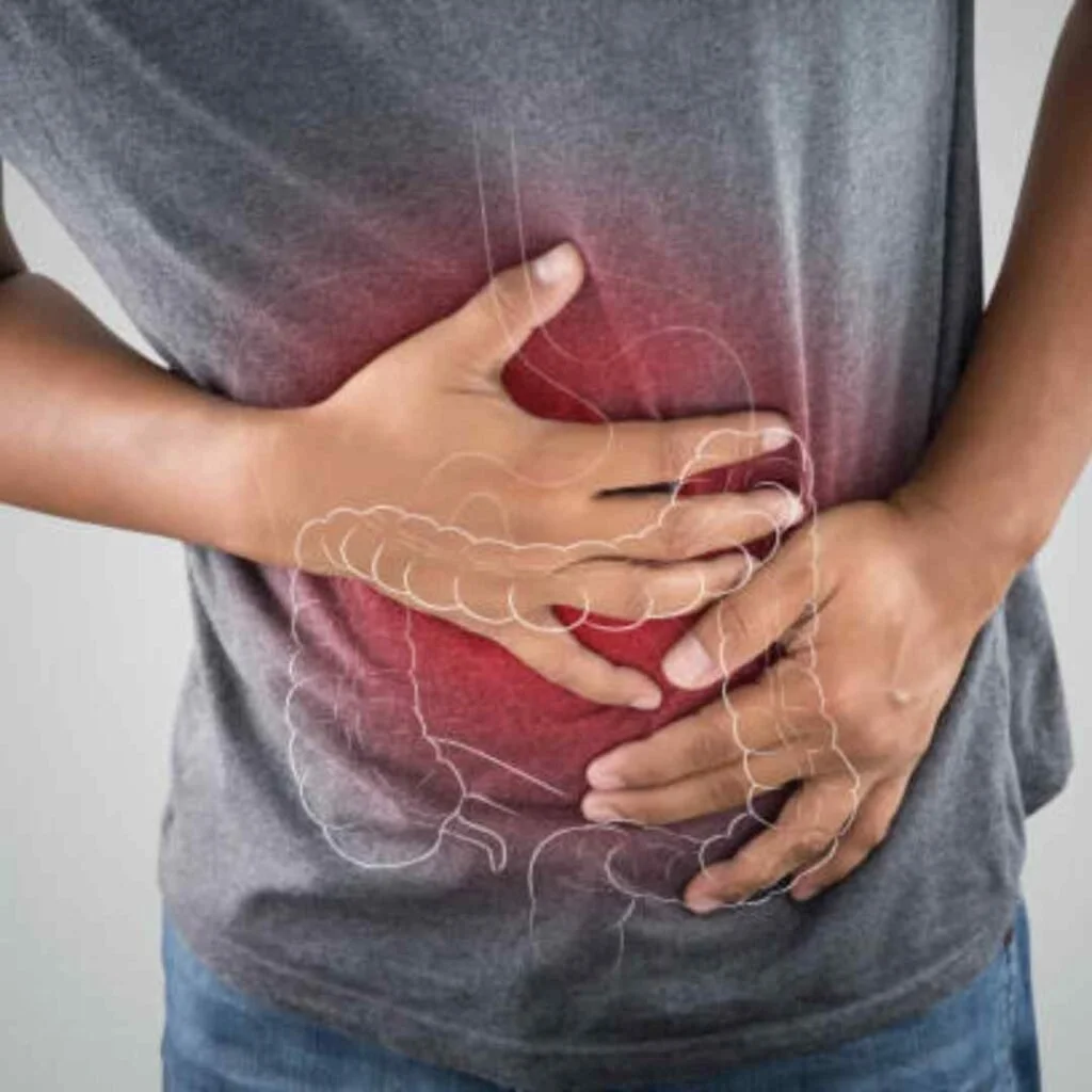 Diarrhea & IBS